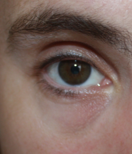 yeux7